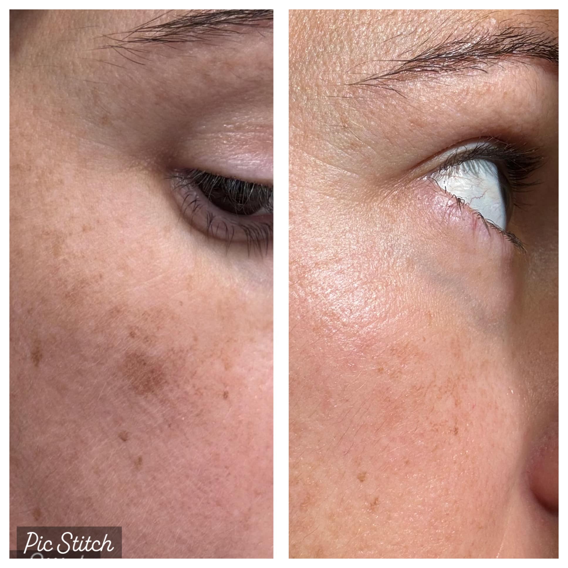 Before and After Image: Case 2 - front