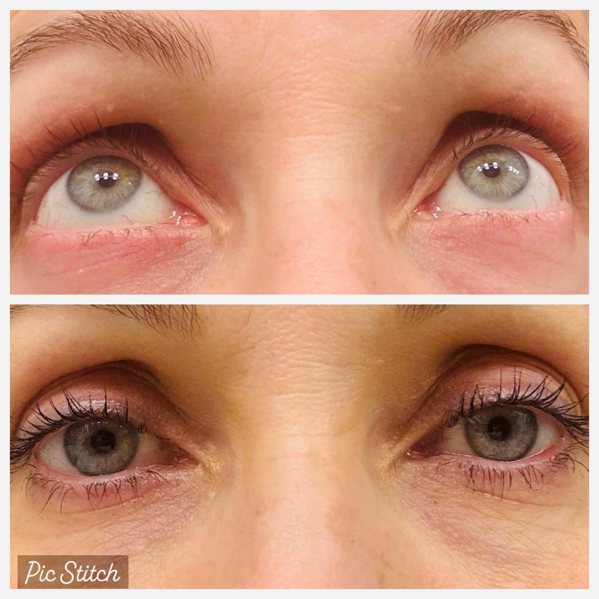 Before and After Image: Case 1 - front