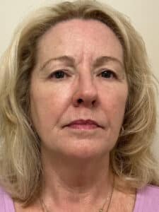 After Image: UltraClear