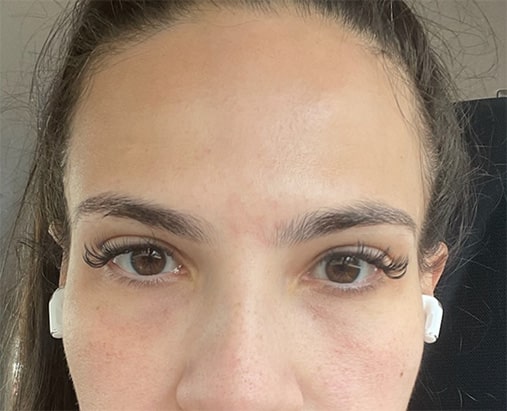 After Image: Ariessance Pure PDGF Under Eye Treatment - front